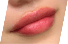 APスキンクリニック銀座 アートメイク症例写真