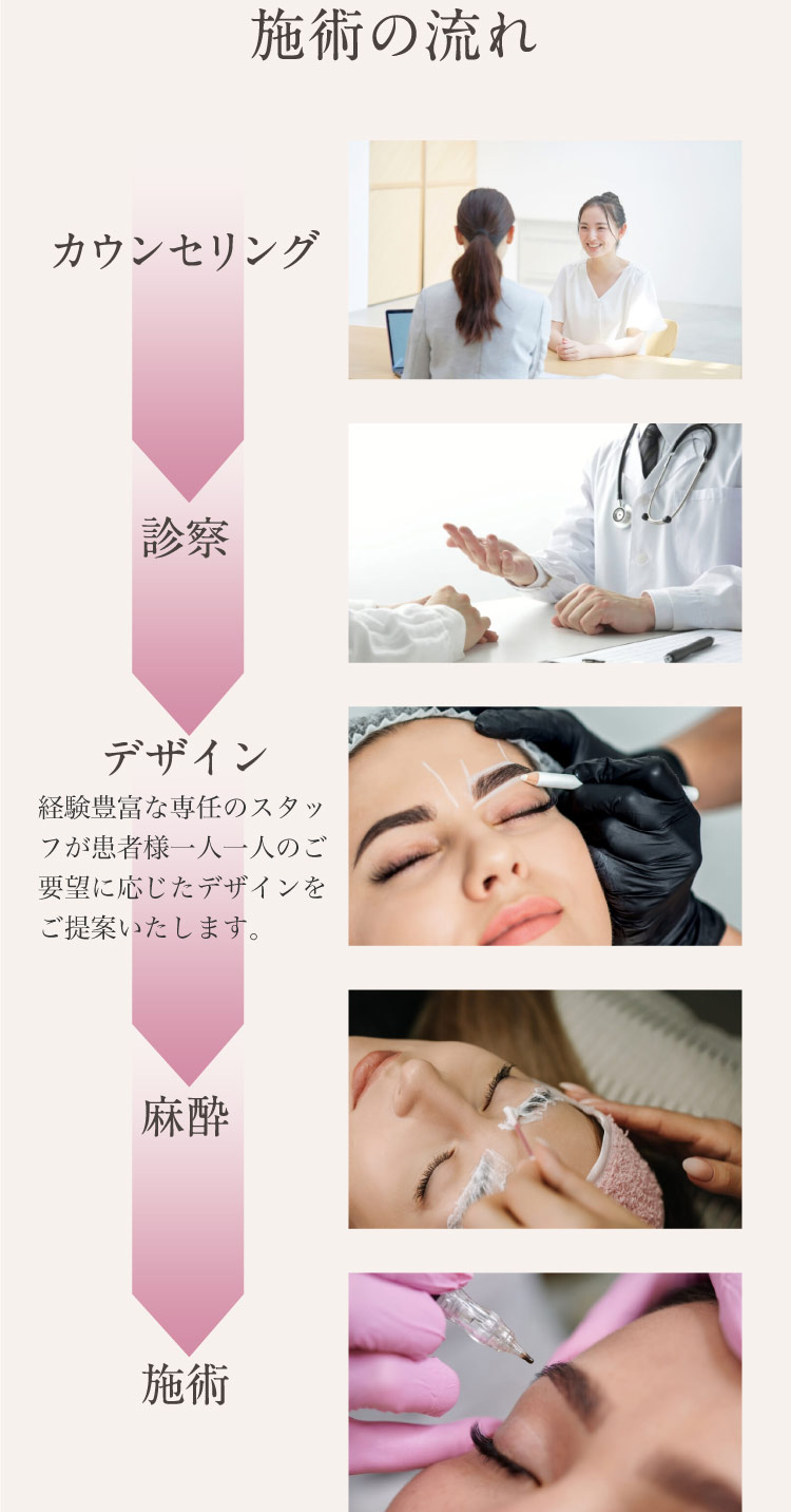施術の流れ