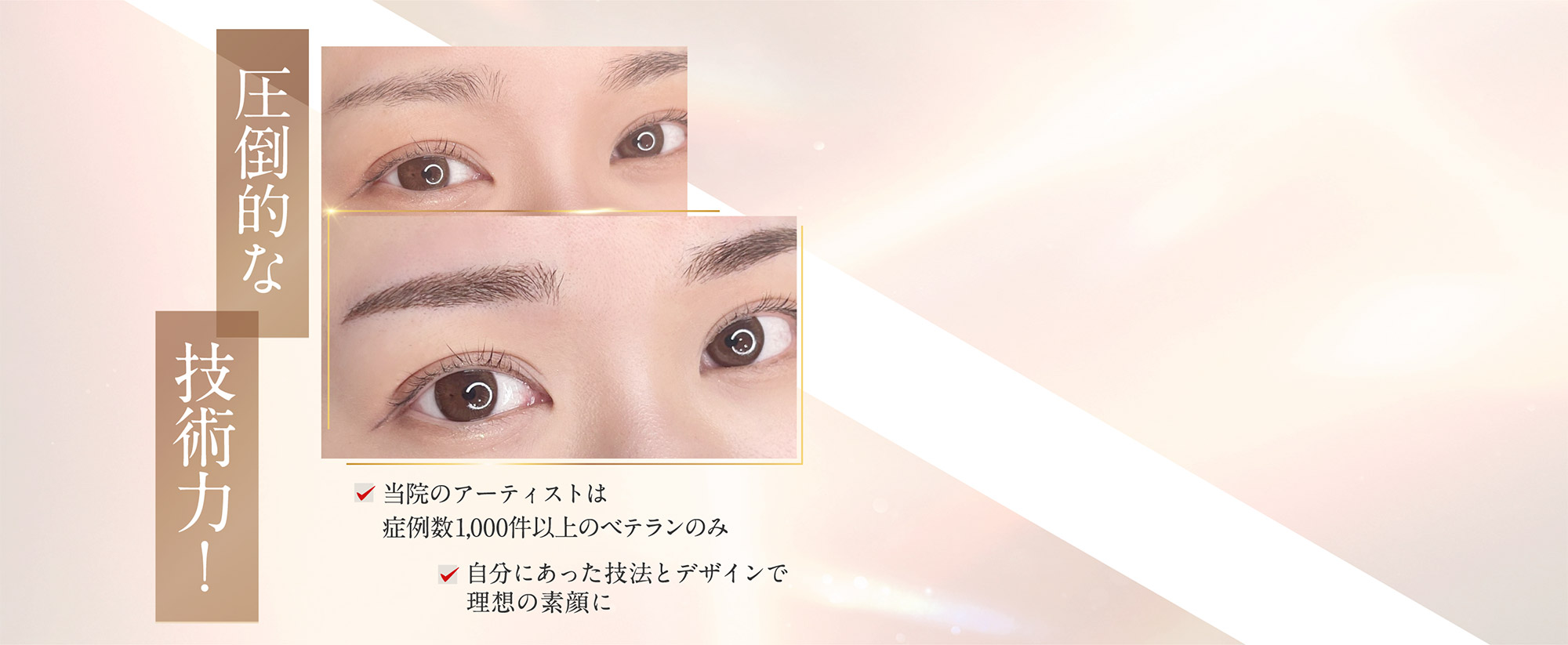 圧倒的な技術力！当院のアーティストは症例数1,000件以上のベテランのみ。自分にあった技法とデザインで理想の素顔に